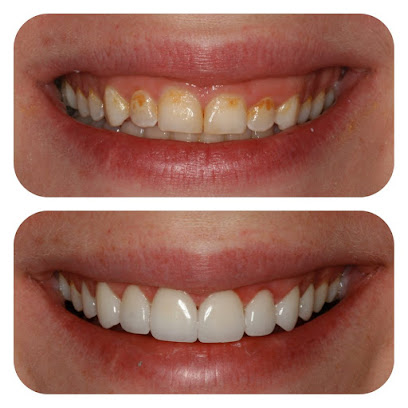 Lasting Smiles